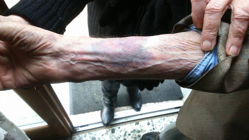 Spuren der Gewalt (Foto: RomaReact)